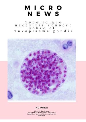 Toxoplasma Gondii