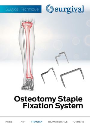 OSTEOTOMY STAPLE SYSTEM ENGLISH