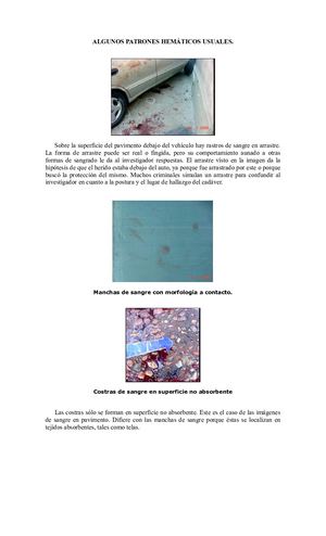 Pericias Para Rastros Hemáticos