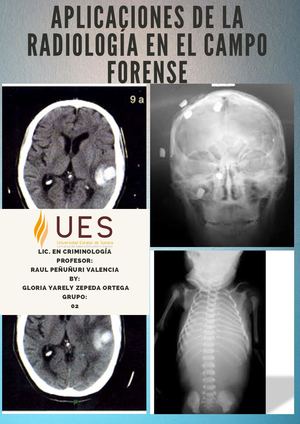 Revista Radiológica Forense