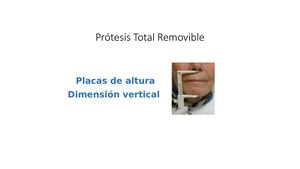 Prótesis Total Removible Placas De Altura Dv Parametros Esteticos