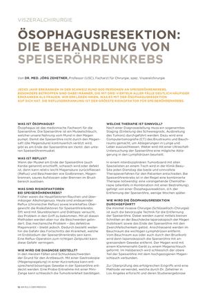 Ösophagusresektion Die Behandlung Von Speiseröhrenkrebs