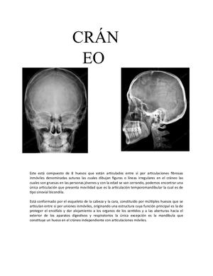 Anatomía Radiológica Craneo