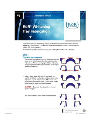 Fabricating KöR Whitening Trays