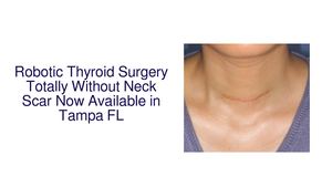 Thyroid Surgery Without Neck Scar Now Available From Scarless Robotic Institute