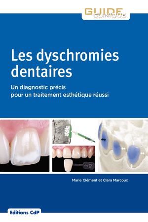 Extrait - Les dyschromies dentaires