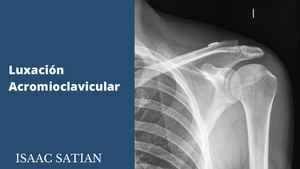 Luxación Acromioclavicular