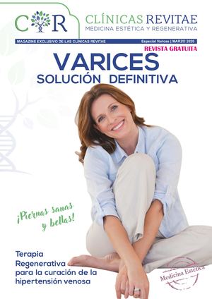 CLÍNICAS REVITAE  NÚM. 2. Especial Varices.