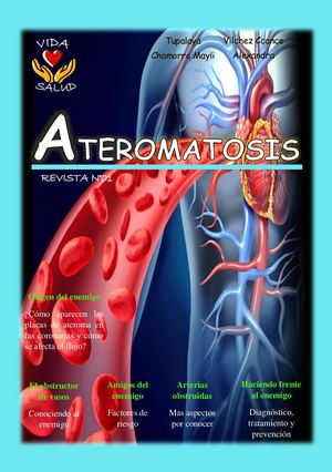 Revista Ateromatosis (Tupalaya, Vilchez) Docx