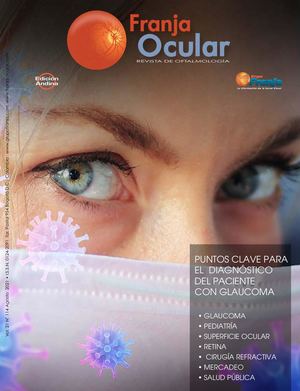 Franja Ocular No. 114