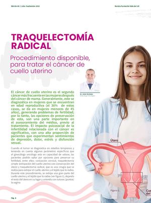 Traquelectomía Radical