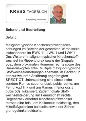 Krebs Tagebuch Befund Und Beurteilung