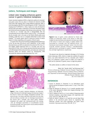 21. Linked Color Imaging Enhances Gastric Cancer In Gastric Intestinal Metaplasia
