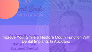 Improve Your Smile & Restore Mouth Function With Dental Implants In Auckland