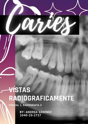 Caries En Radiografías