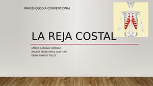 La Reja Costal