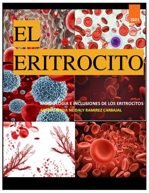 El Eritrocito