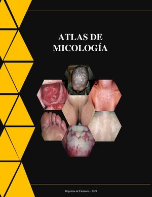 Atlas Micología