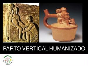 Parto Vertical Humanizado 1