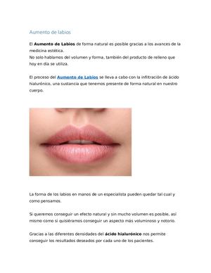Aumento Natural De Labios