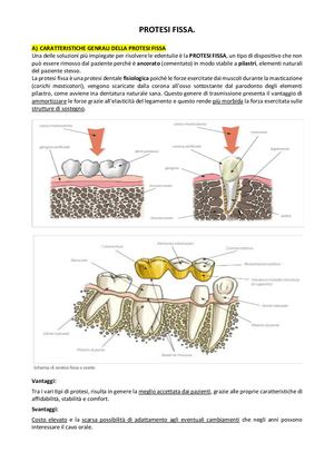 Protesi Fissa
