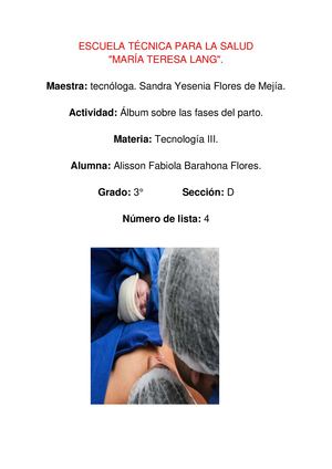 Álbum: fases del Parto