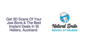 Get 3D Scans Of Your Jaw Bone & The Best Implant Deals In St Heliers, Auckland