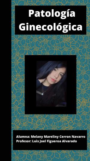 Portafolio_Mareliny Melany Cerron  Navarro