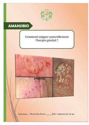 Comment Soigner Naturellement L’herpès Génital