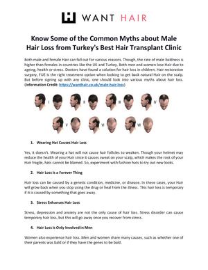 Know Some of the Common Myths about Male Hair Loss from Turkey’s Best Hair Transplant Clinic