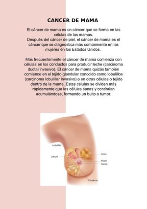 Cancer de mama