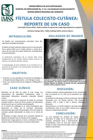 #IDoR2022_CARTEL FISTULA COLECISTO CUTANEA REPORTE DE UN CASO