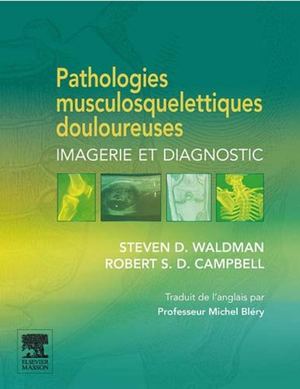 Pathologies Musculosquelletiques Douloureuses