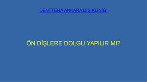 öN Diş Dolgusu Nasıl Yapılır?