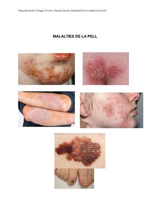 Grup 3 Projecte Malalties De La Pell