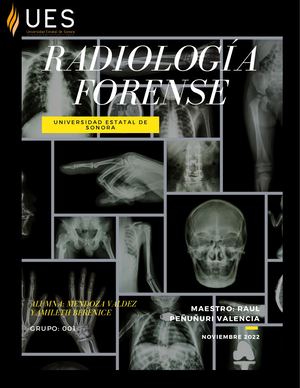 Radiología Forense
