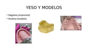 Yeso Y Modelos Impresiones No Elásticas