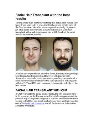 Facial Hair Transplant With The Best Results