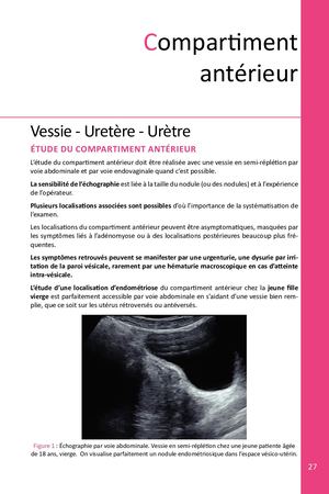 ATLAS ÉCHOGRAPHIQUE DE L'ENDOMÉTRIOSE