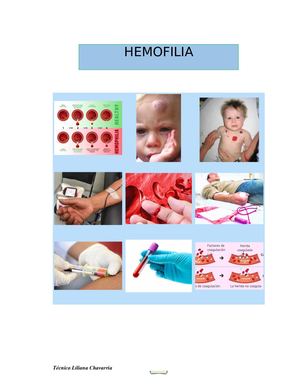 Hemofilia