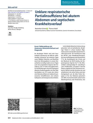 13 Unklare Respiratorische Partialinsuffizienz Bei Akutem Abdomen Und Septischem Krankheitsverlauf