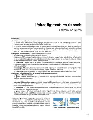 SAVOIR FAIRE EN RADIOLOGIE OSTÉO-ARTICULAIRE N°25