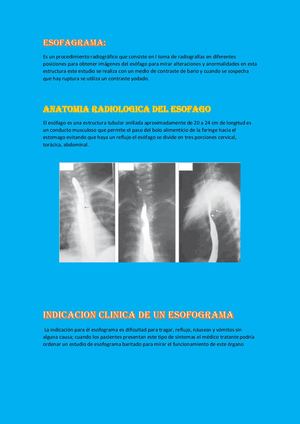 Esofagograma Cepre Pielografia