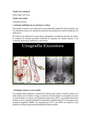 Urografia Excretora