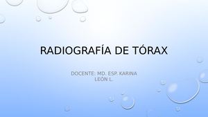 Radiografía De Tórax