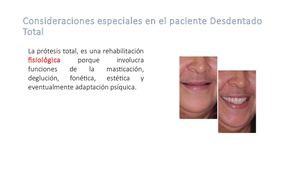 Prostodoncia Generalidades