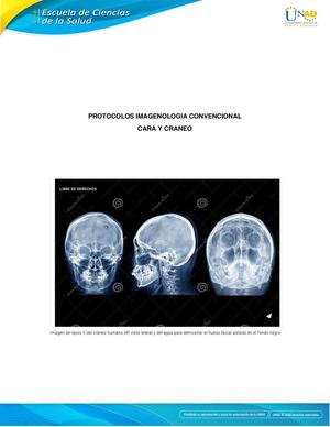 Protocolos Imagenologia Craneo Rodriguez Milanca