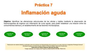 7 Práctica Inflamación Aguda