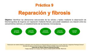 9 Práctica Reparación Y Fibrosis