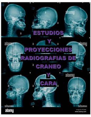Estudios Y Proyecciones Radiograficos Craneo Y Cara